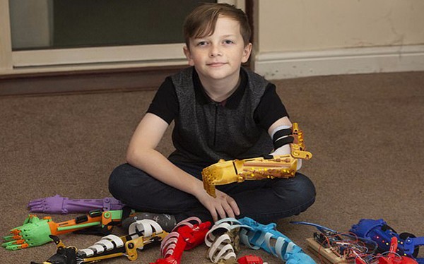 感動!英父親為無臂兒子3D打印9只個性仿生臂