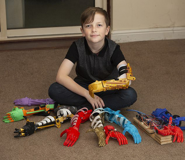 感動!英父親為無臂兒子3D打印9只個性仿生臂(圖1) 感動!英父親為無臂兒子3D打印9只個性仿生臂(圖1)