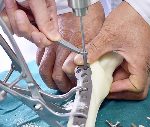 3D打印技術在骨科的實際應用有哪些?(圖2) 3D打印技術在骨科的實際應用有哪些?(圖2)