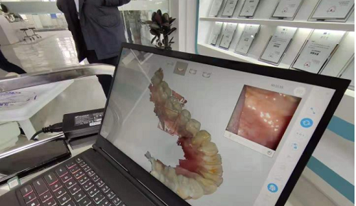  3D打印技術在牙科義齒領域中牙套制作的應用是怎樣的呢？(圖2)